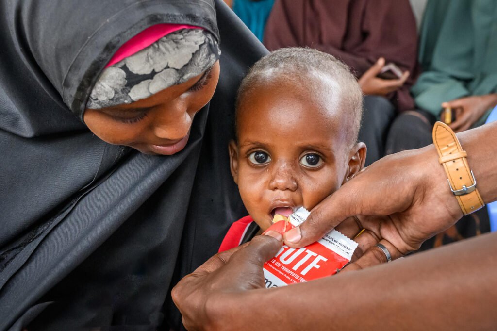 Somalilainen pikkulapsi syö hänelle syötettyä maapähkinätahnaa hätäapuruokana aliravitsemukseen.